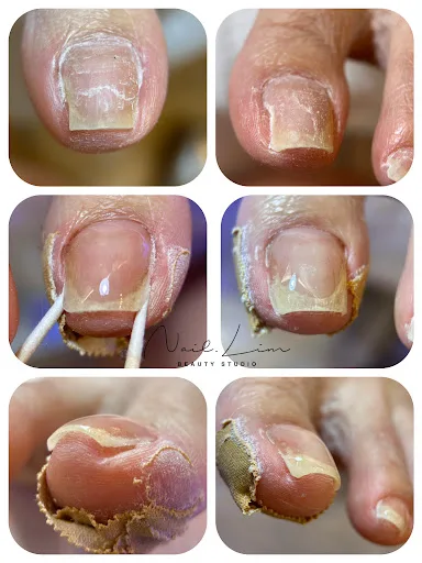 Nail Lim Beauty